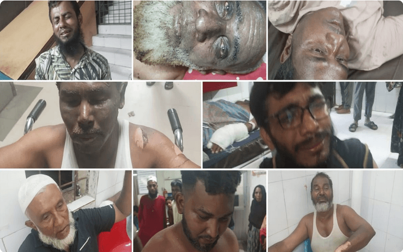 চট্টগ্রামে লোহার ডিপোতে বিস্ফোরণে ৮ শ্রমিক দগ্ধ