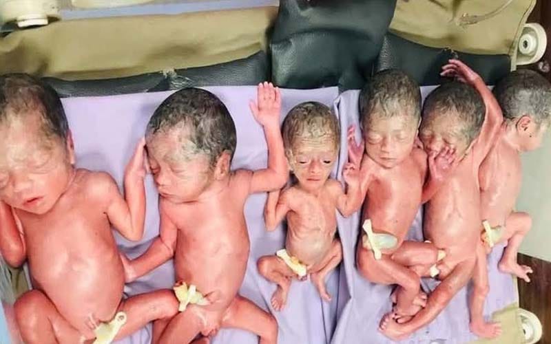 চট্টগ্রামে এবার ৬ সন্তান জন্ম দিয়ে রেকর্ড গড়লেন কক্সবাজারের মরিয়ম
