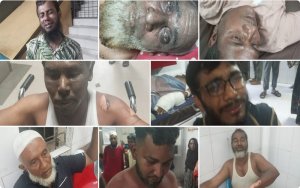 চট্টগ্রামে লোহার ডিপোতে বিস্ফোরণে ৮ শ্রমিক দগ্ধ